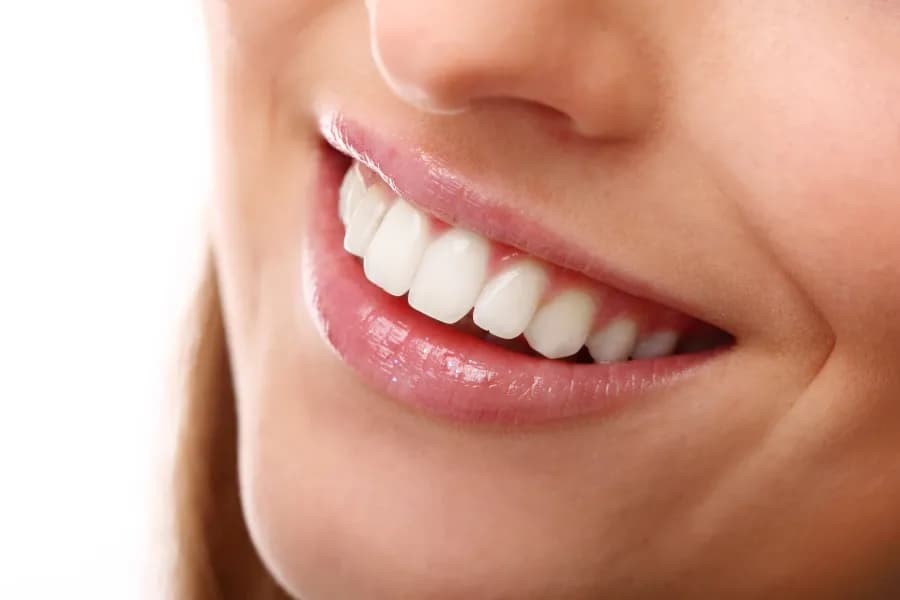 รอยยิ้มฟันขาวหลังฟอกสีฟัน